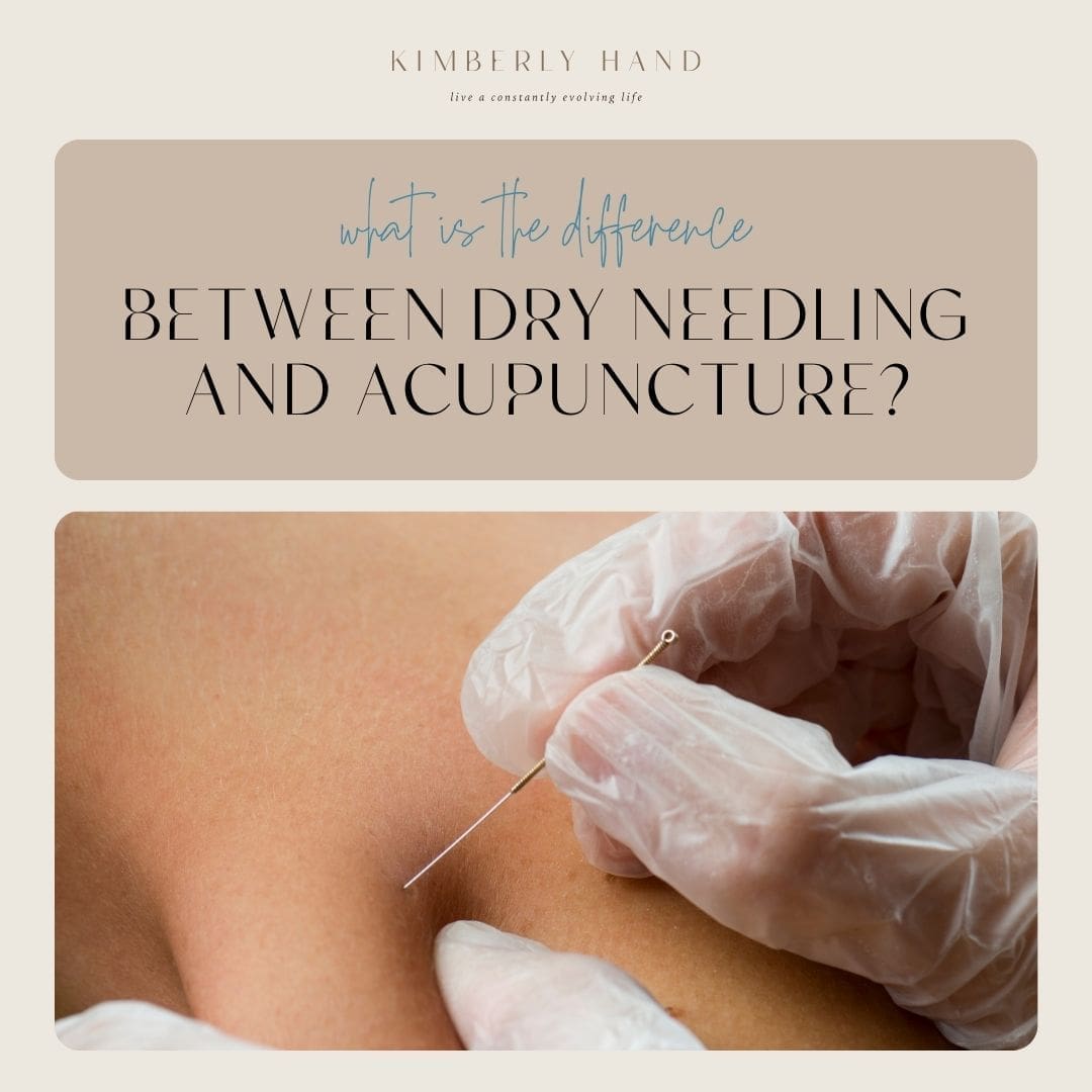 What Is The Difference Between Dry Needling And Acupuncture
