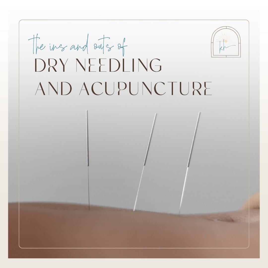 The ins and out of dry needling and acupuncture
